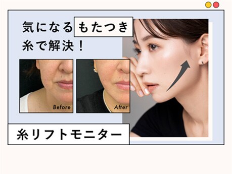 切らずにリフトアップ！溶ける糸リフトで、美しいフェイスラインに！