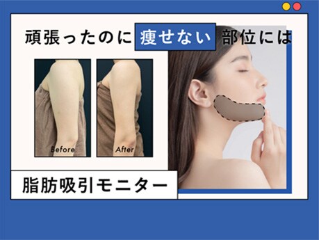 気になる二の腕や顔周りの脂肪を根こそぎ吸引！