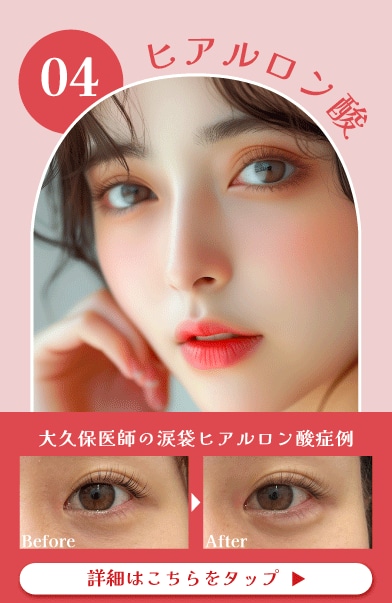 【ヒアルロン酸】これ一つでシワやハリ・肌質改善が叶います!