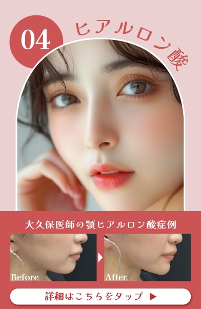 【ヒアルロン酸】これ一つでシワやハリ・肌質改善が叶います！