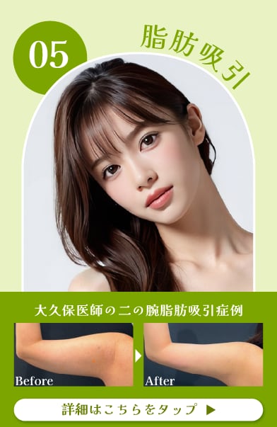 【脂肪吸引】華奢な二の腕も小顔も叶えます！