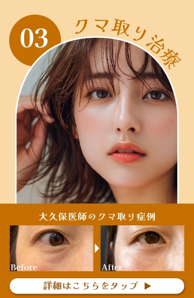 【クマ取り】老け顔・疲れ顔解消✨