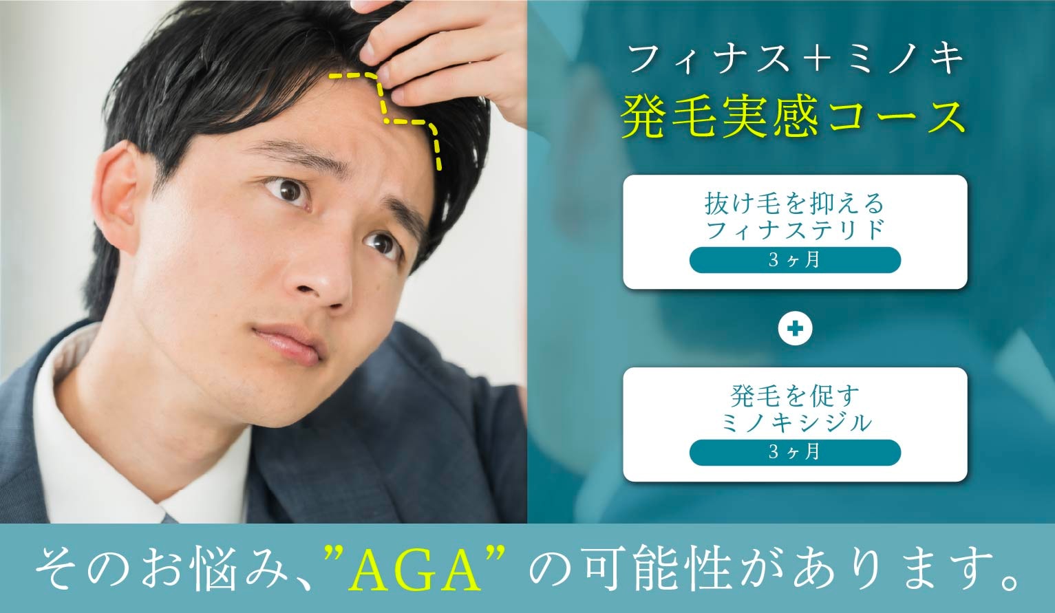 ①低価格で受けられる