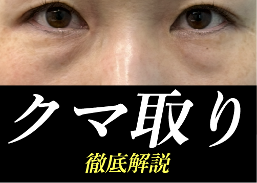 【クマ/目の下のたるみ】湘南美容クリニック秋田院でできるクマ取り