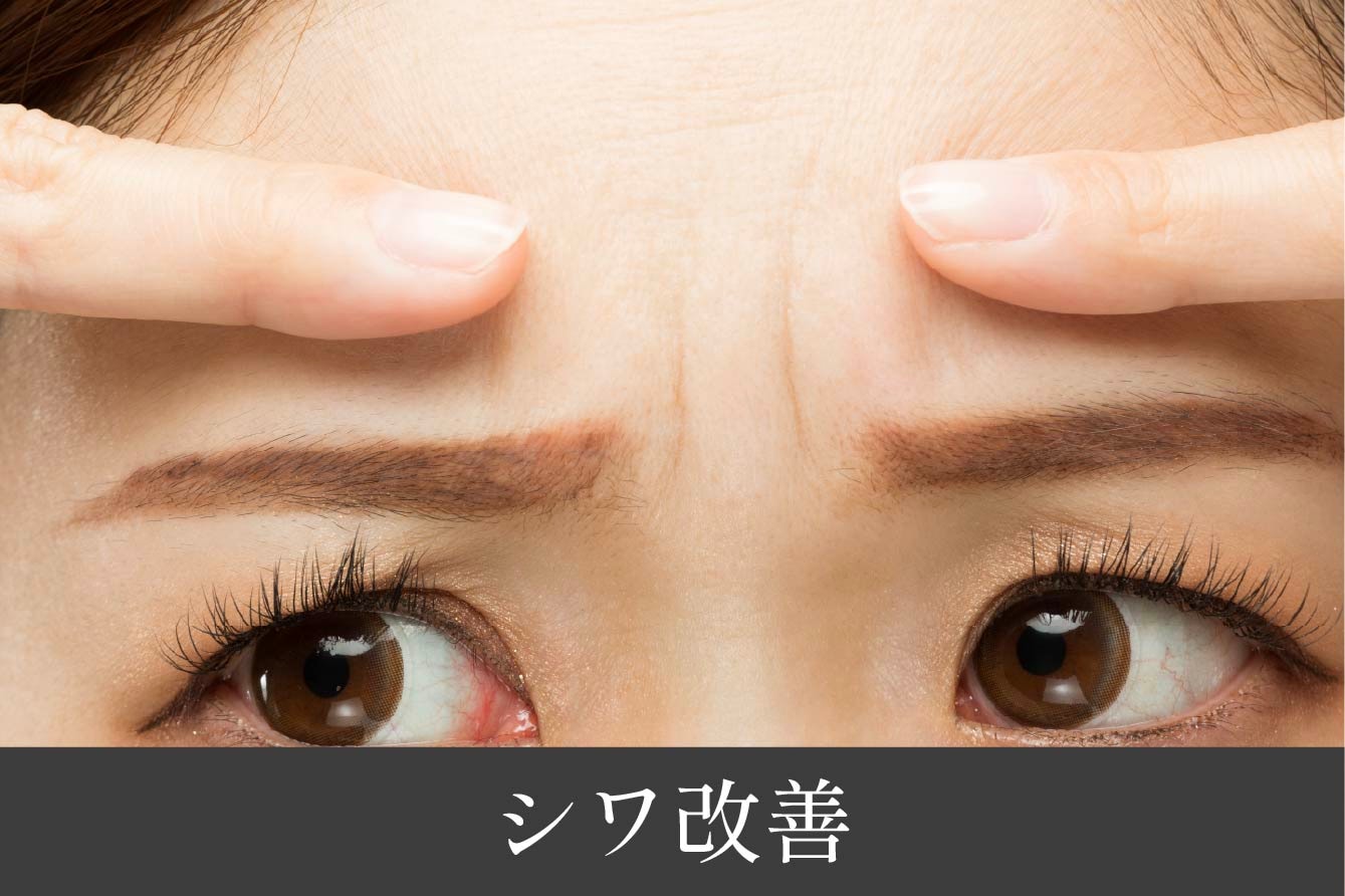 シワ改善