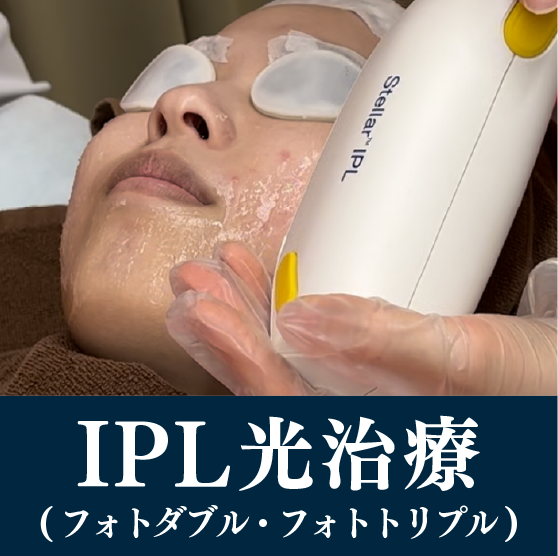 IPL光治療(フォトダブル・フォトトリプル)