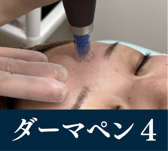 ダーマペン4