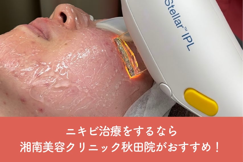 ニキビ治療をするなら秋田院がおすすめ！