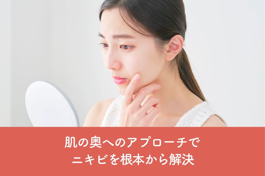 ニキビを根本から解決したり肌質から改善したい場合