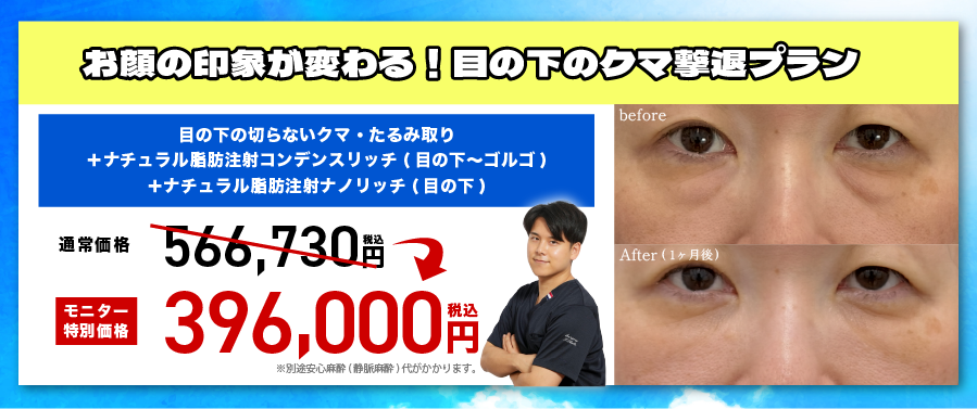 【10名限定】目の下のクマ撃退プラン✨