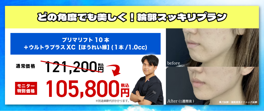 【10名限定】輪郭スッキリプラン✨