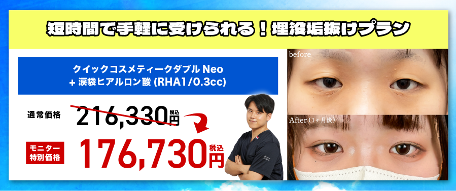 【10名限定】埋没垢抜けプラン✨