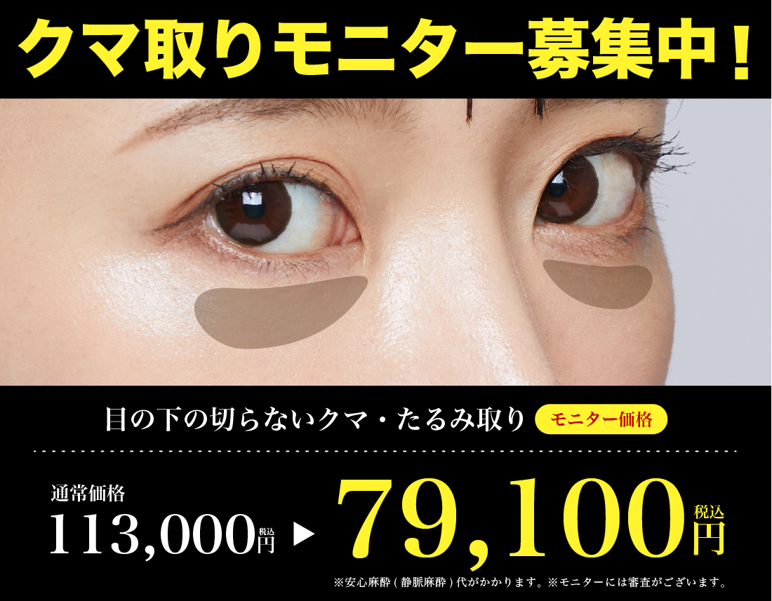 クマ取りモニター募集中！