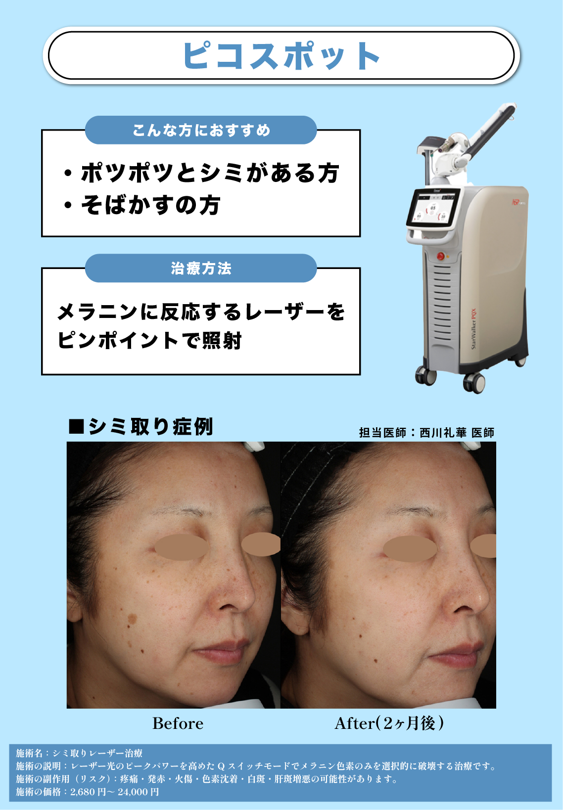 シミ・そばかす・ADMにお悩みの方