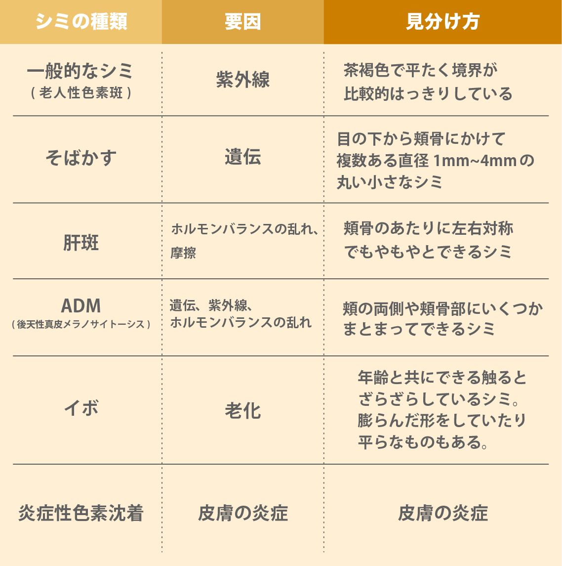シミの見分け方と種類ごとの要因
