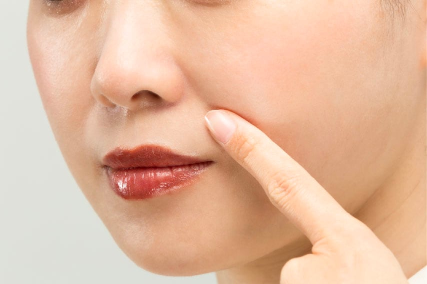 溝を「埋める」ではなく「支える」注入で、自然なリフトアップ✨