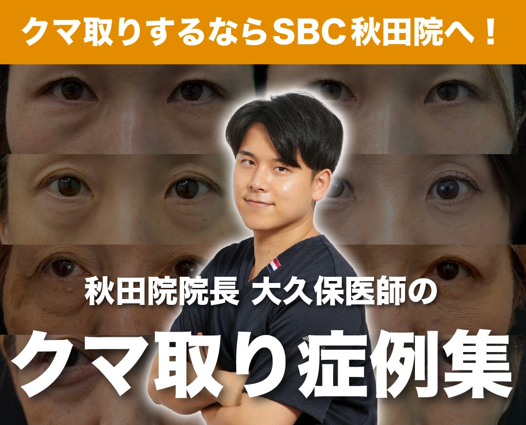 【クマ取り】大久保医師のクマ取り症例特集✨