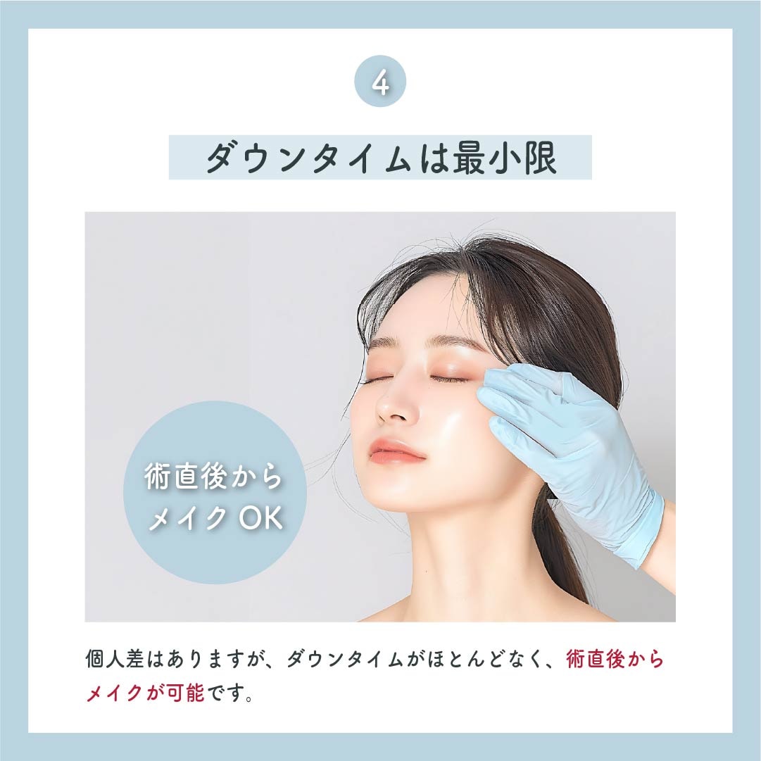 4.ダウンタイムは最小限