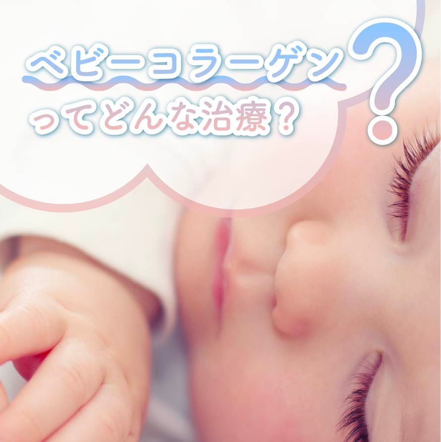 ベビーコラーゲンで肌の弾力や保湿力UP!