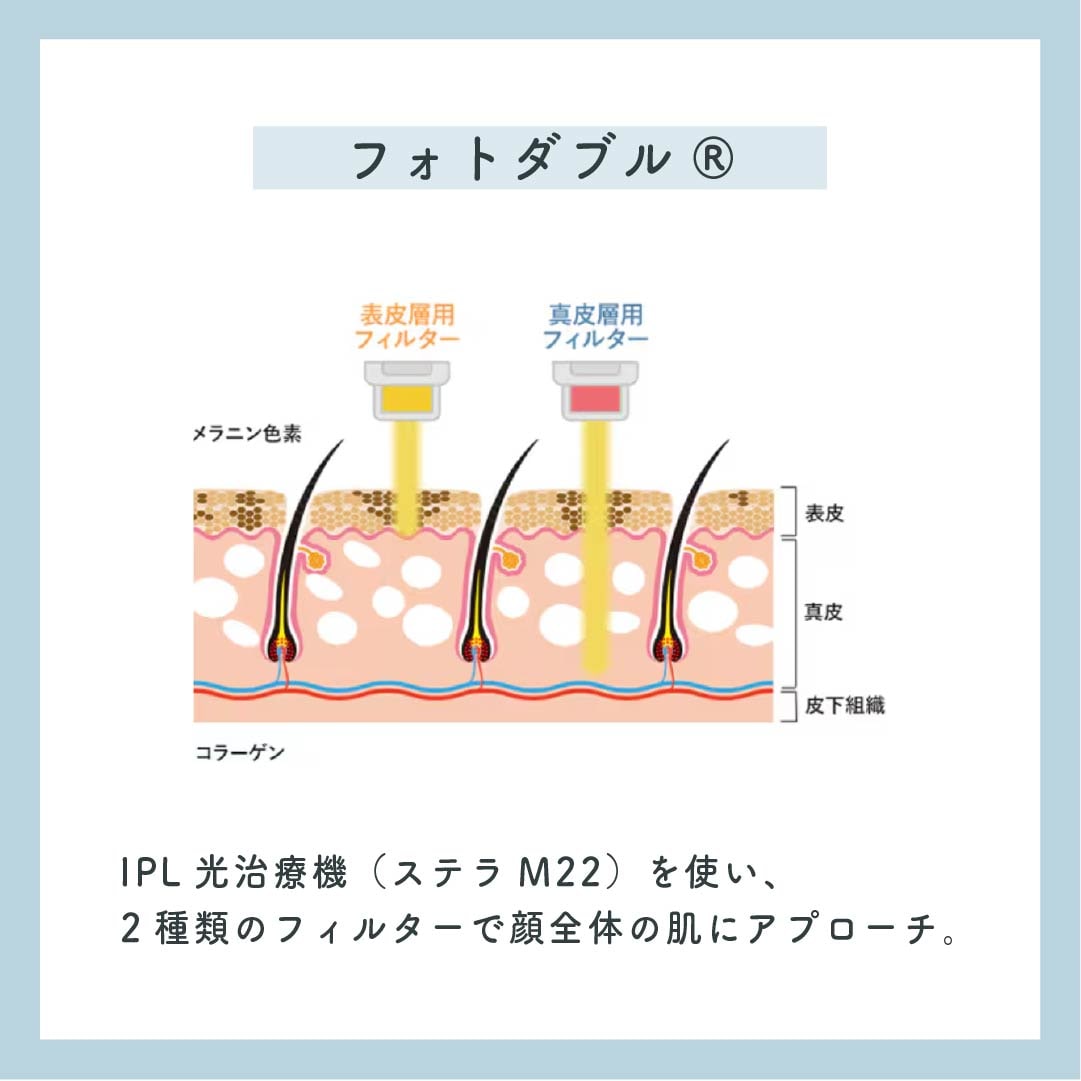 フォトダブル®