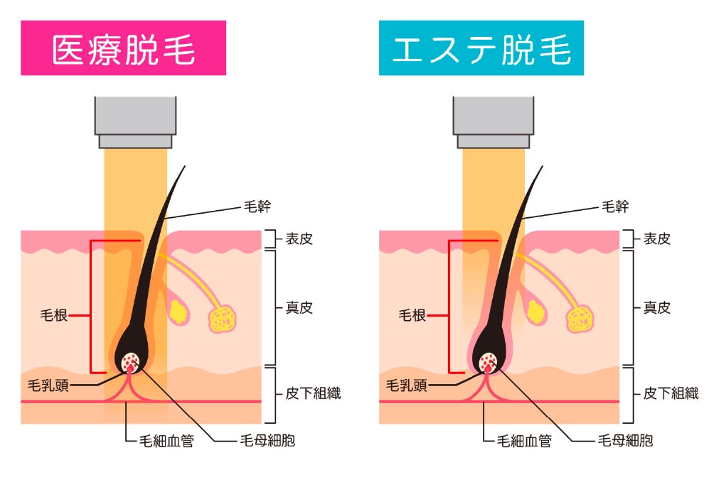 少ない回数で確実に