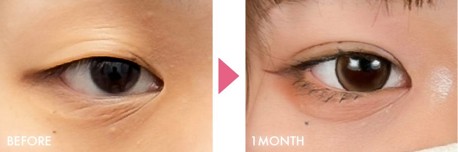 クイックコスメティーク・ダブルNeo