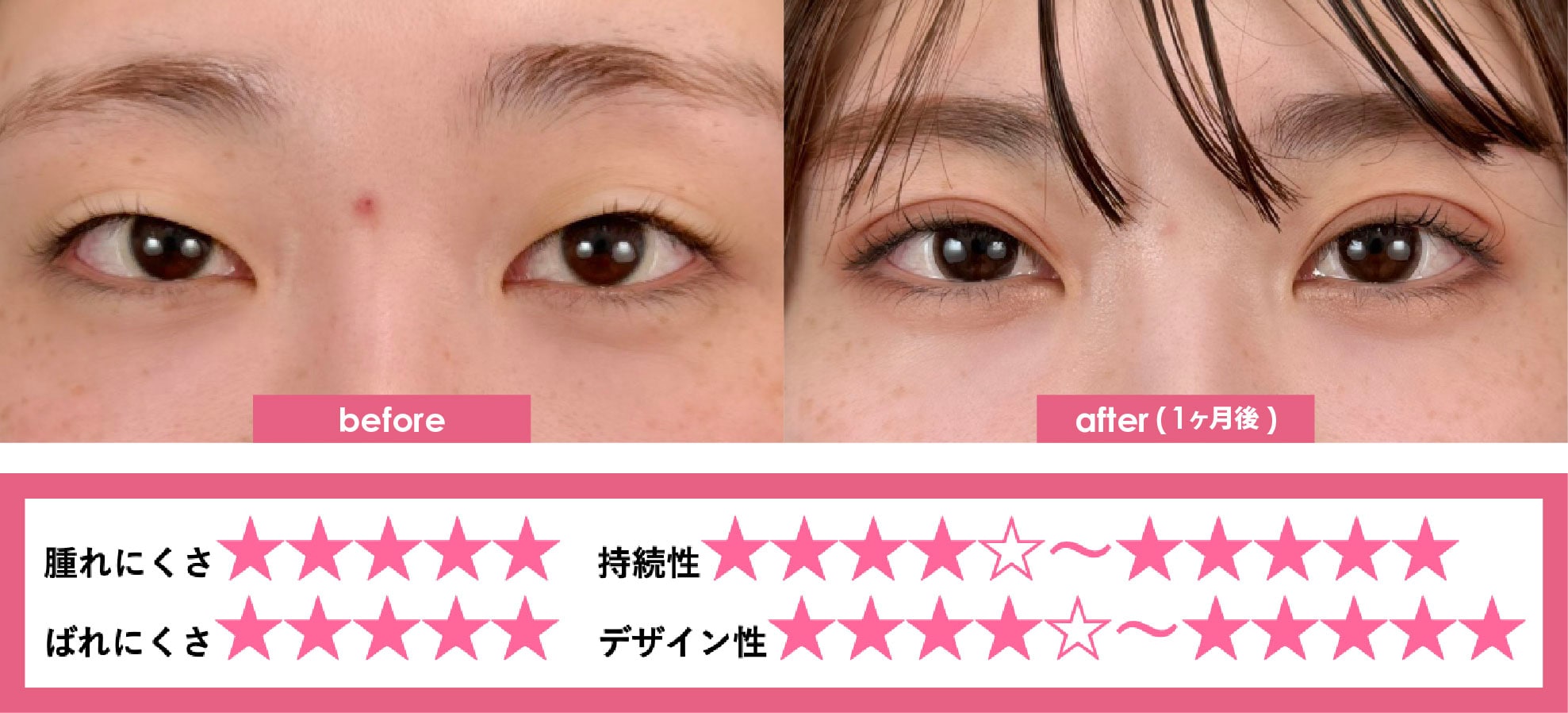 クイックコスメティークNeo