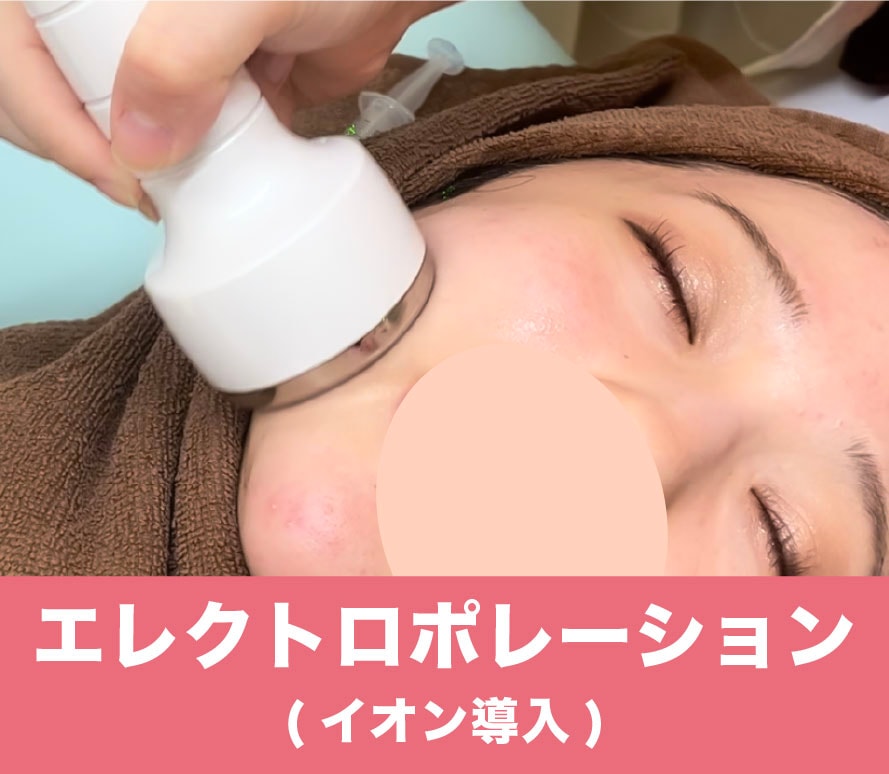 エレクトロポレーション(イオン導入)