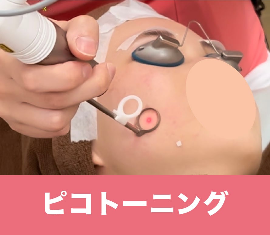 ピコトーニング