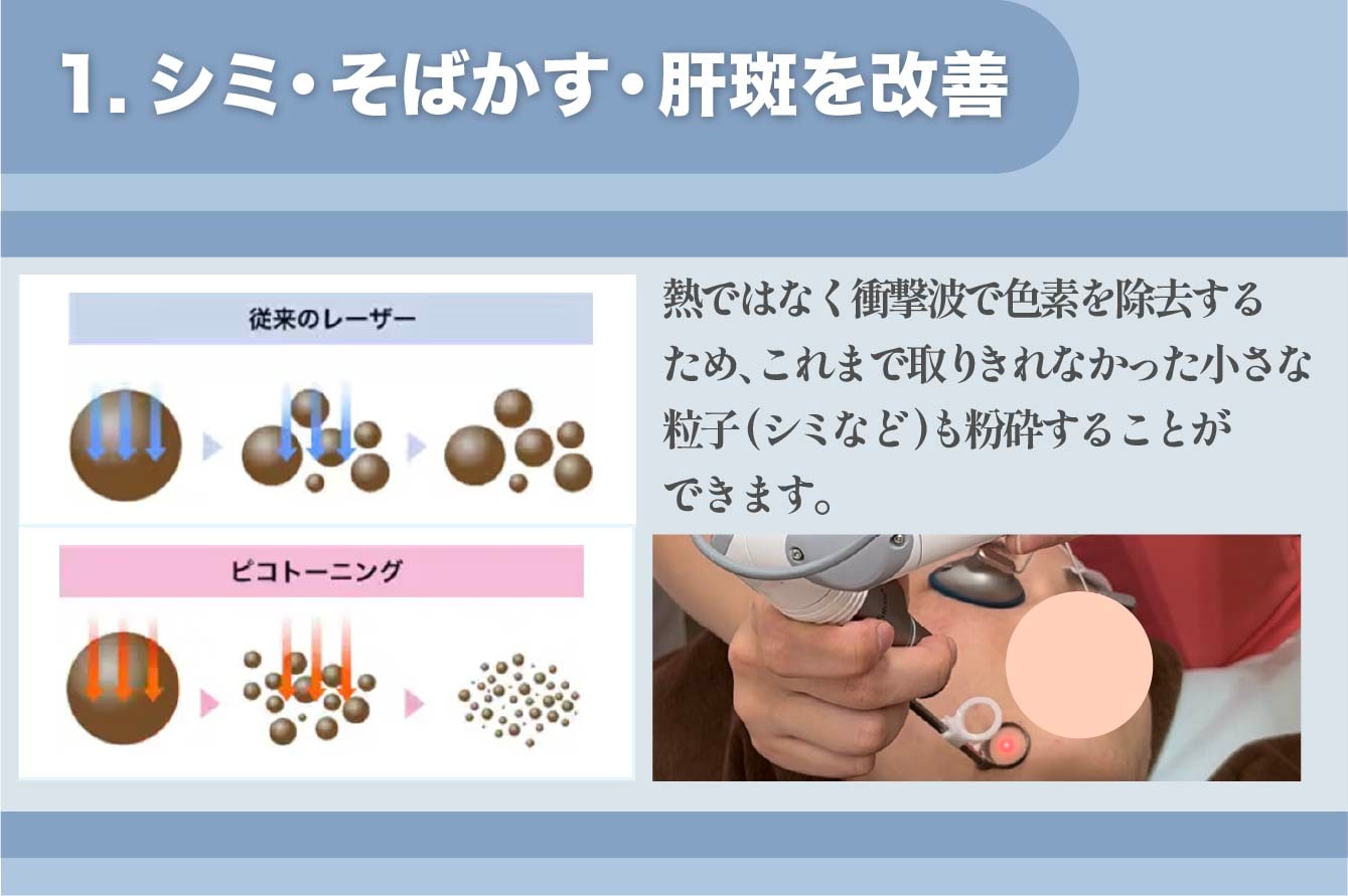 1.シミ・そばかす・肝斑を改善