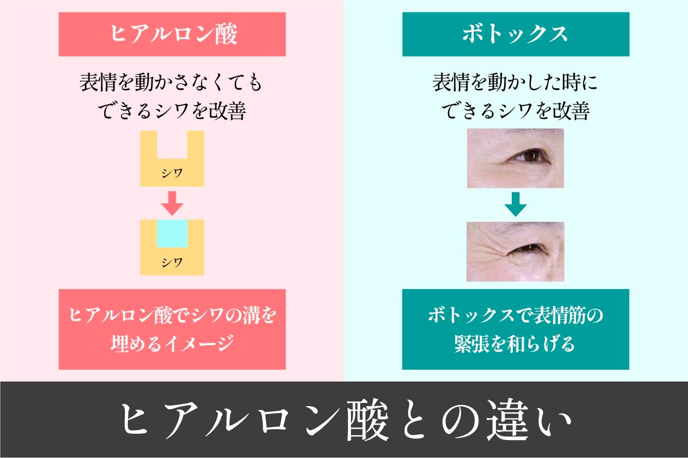 同じシワ治療でも結構違う