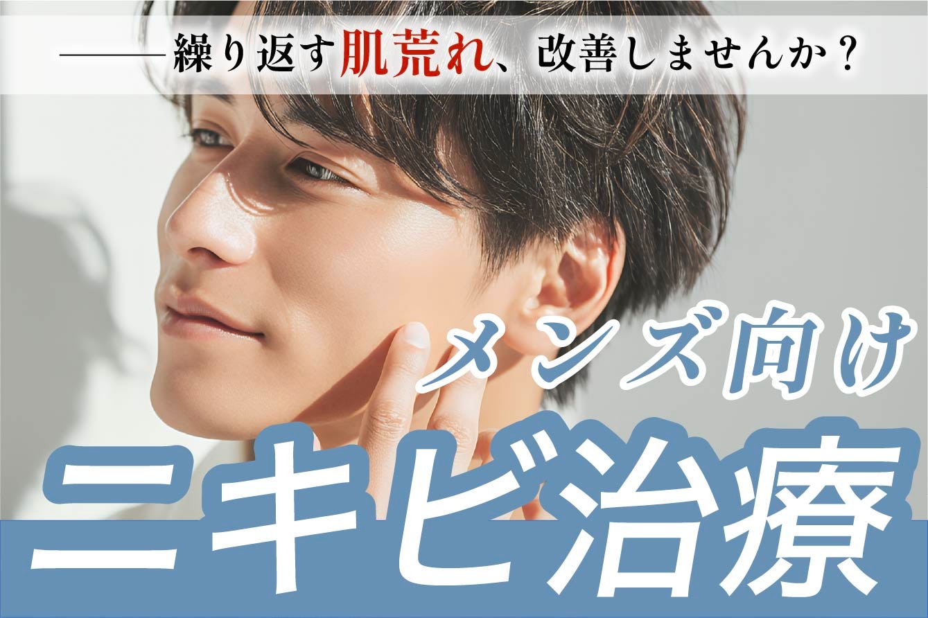 【メンズ向けニキビ治療】男性必見‼️美肌作りならSBC秋田へ✨