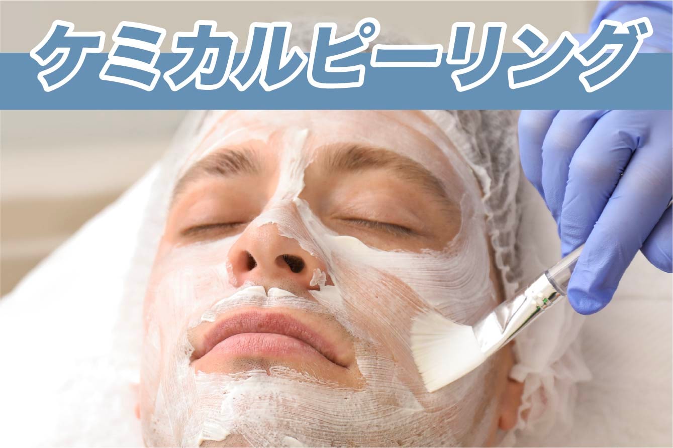 【ニキビ・皮脂トラブル】ケミカルピーリング