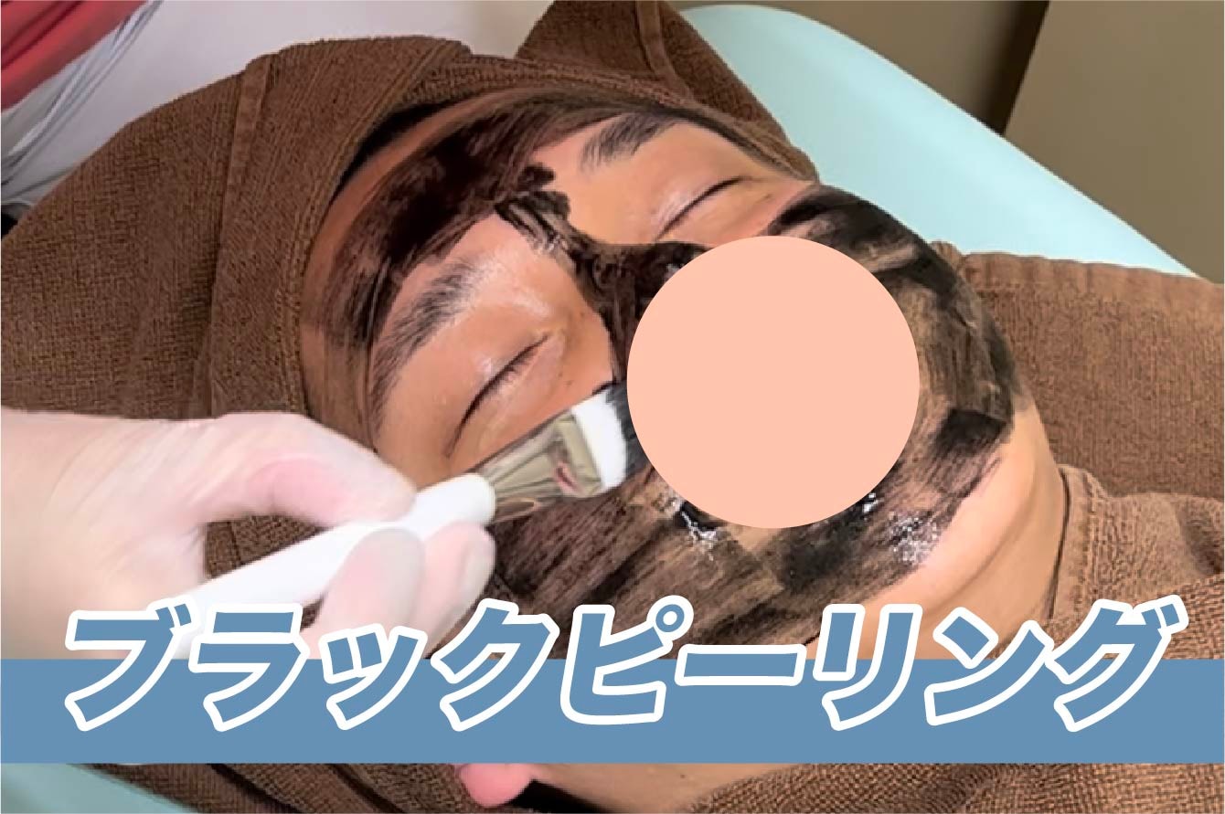 【毛穴・テカリ・ざらつき】ブラックピール