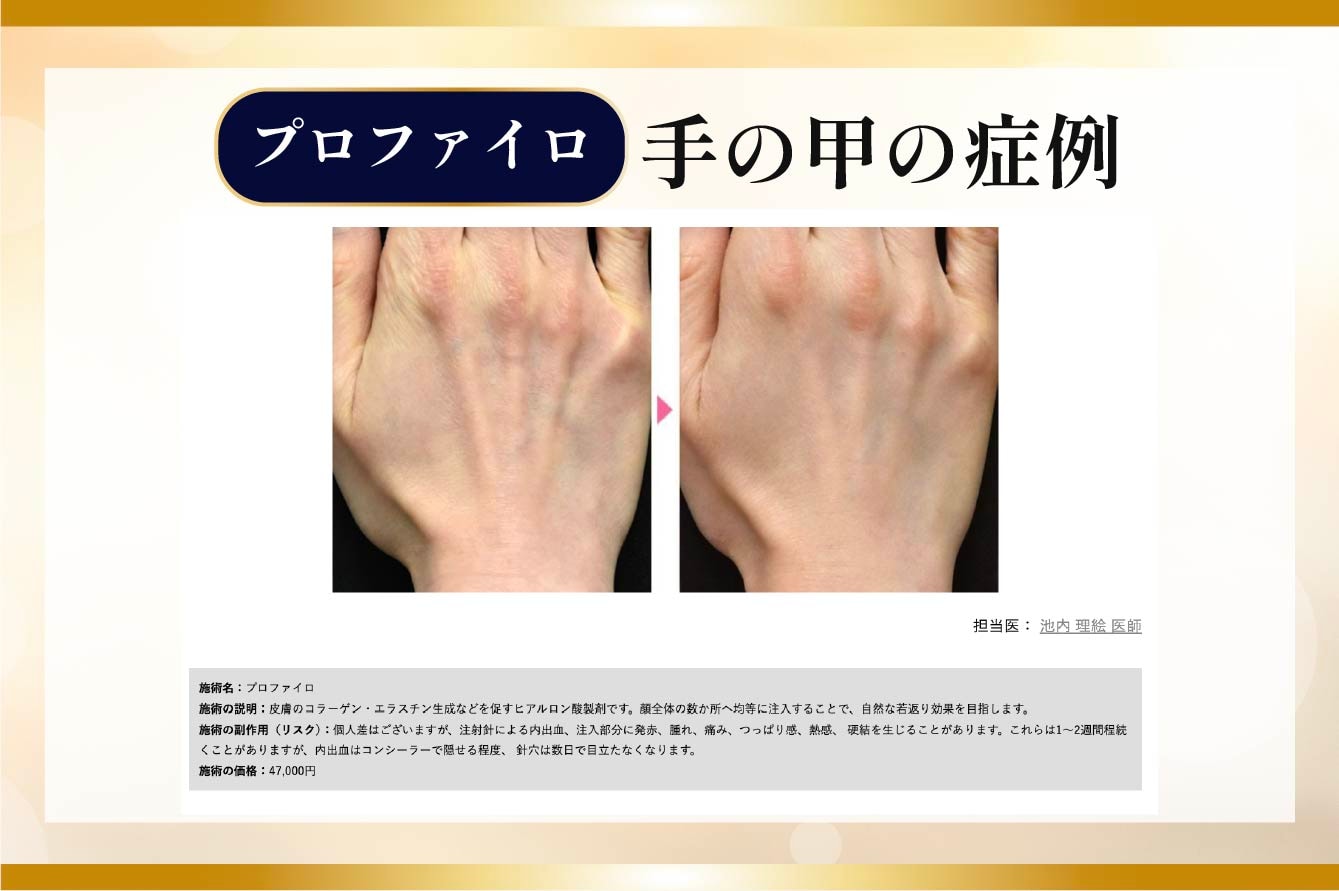 手の甲のシワも一目瞭然！