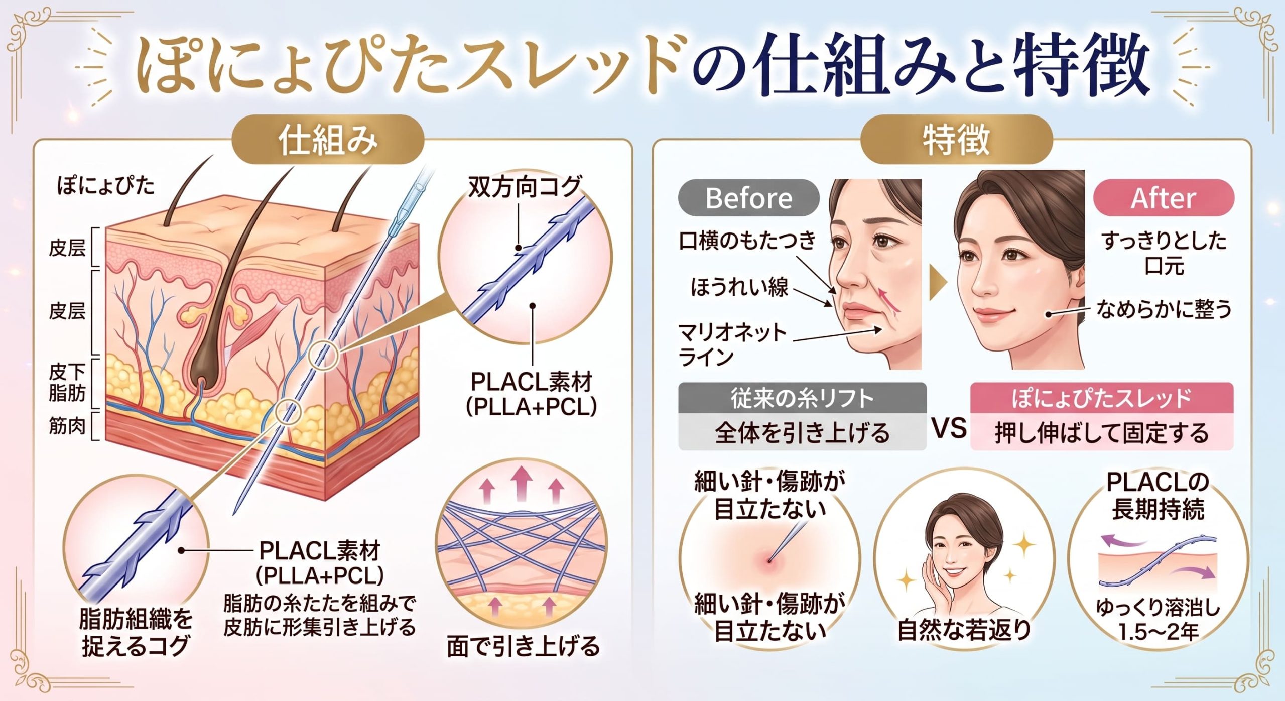 ぽにょぴたスレッドの仕組みと特徴