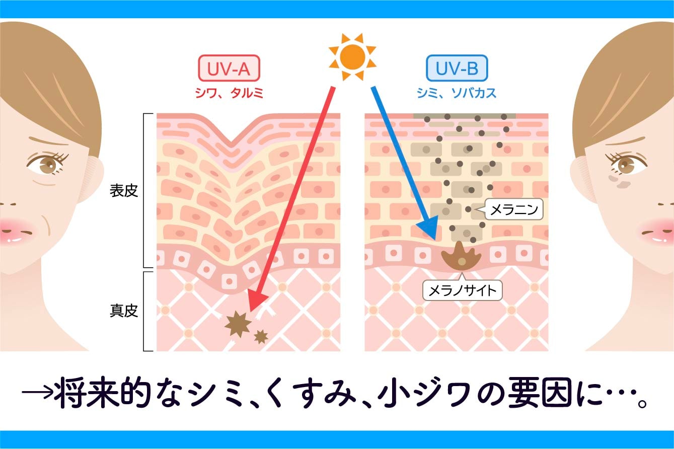 紫外線ダメージの正体