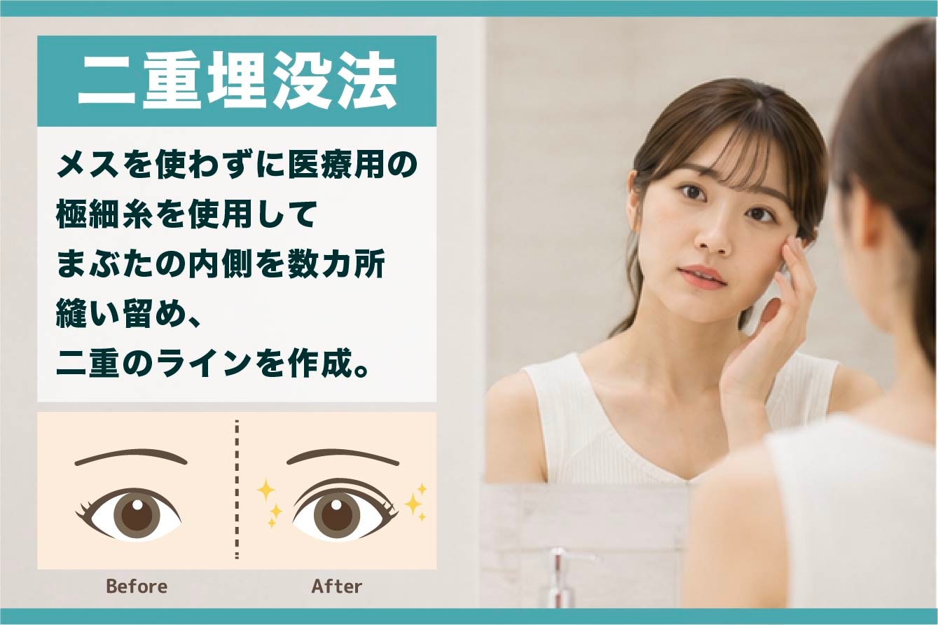 二重埋没法（切らない二重術）とは
