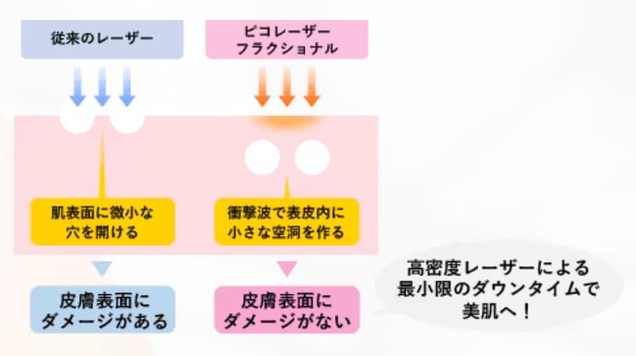 ピコフラクショナル