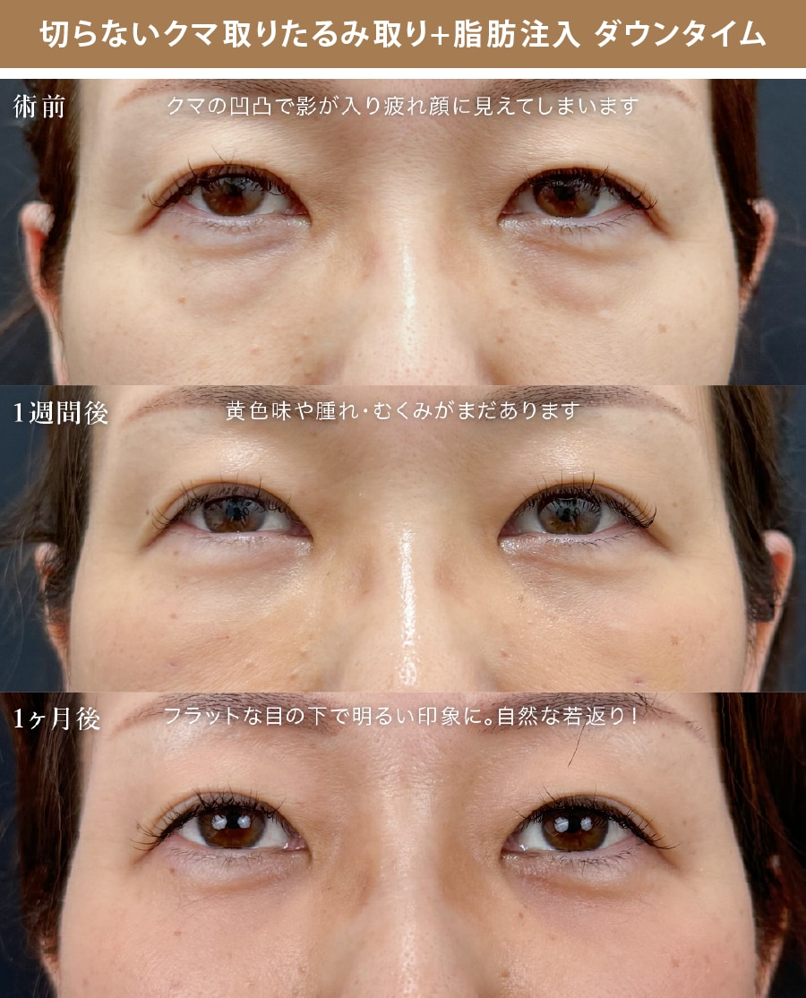 1週間後をご覧ください