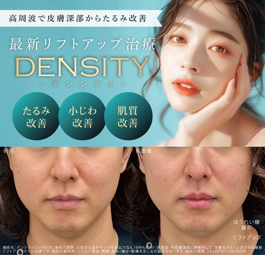 高周波で皮膚の奥深くからたるみ改善