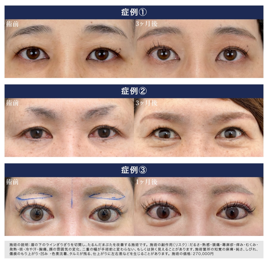 小原医師の症例写真