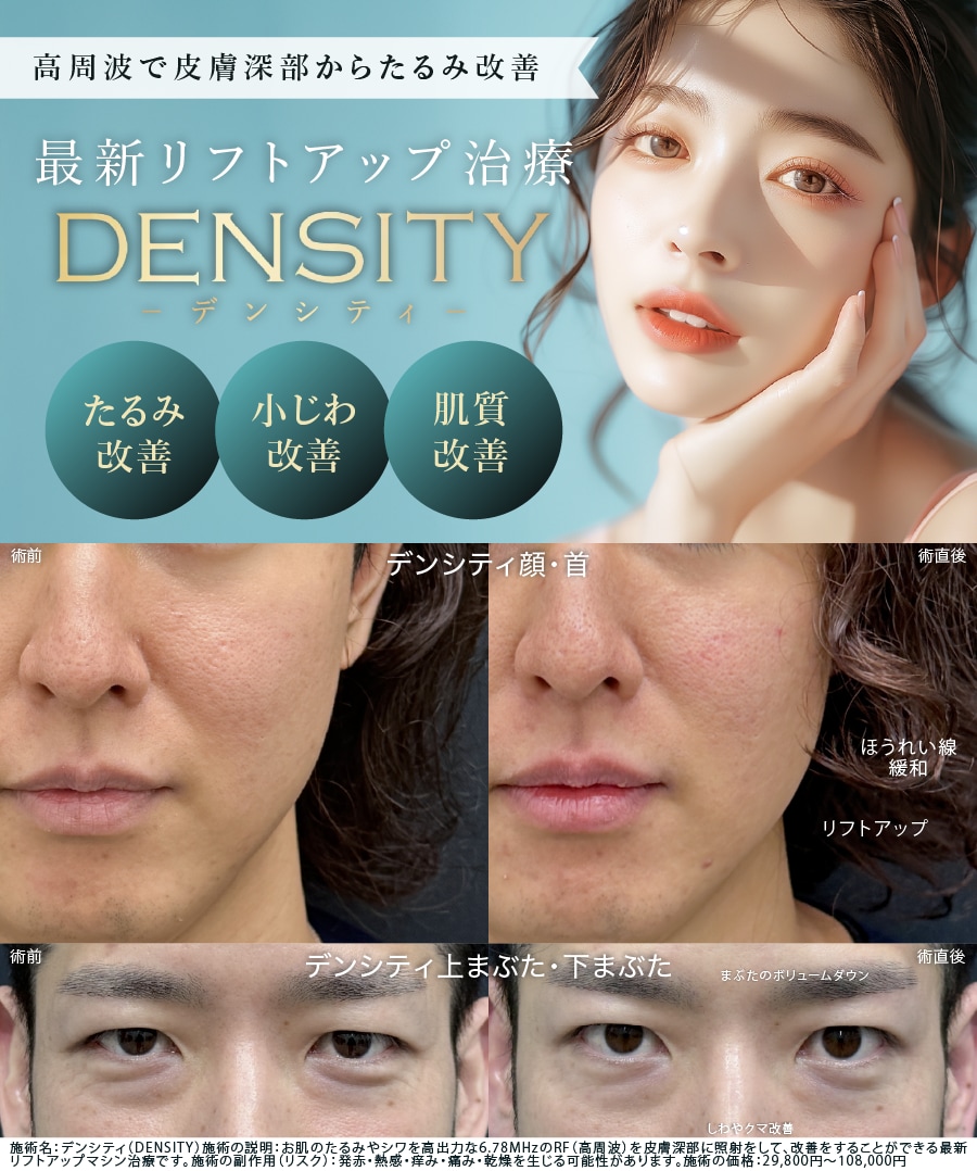 デンシティ症例写真