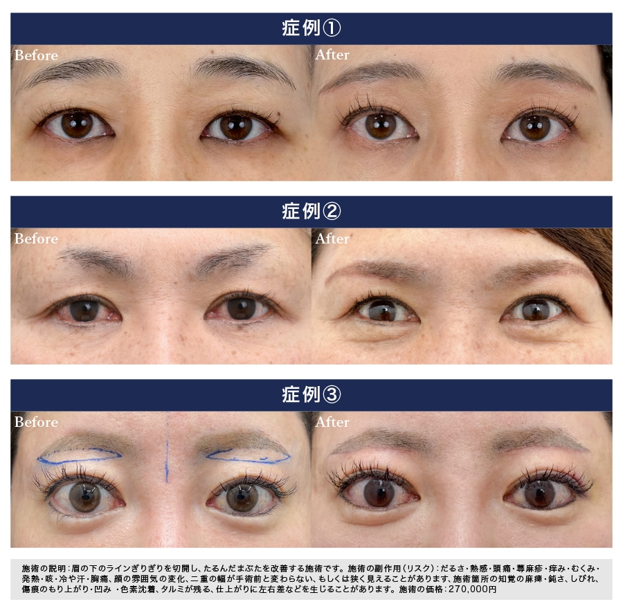 小原医師の症例写真