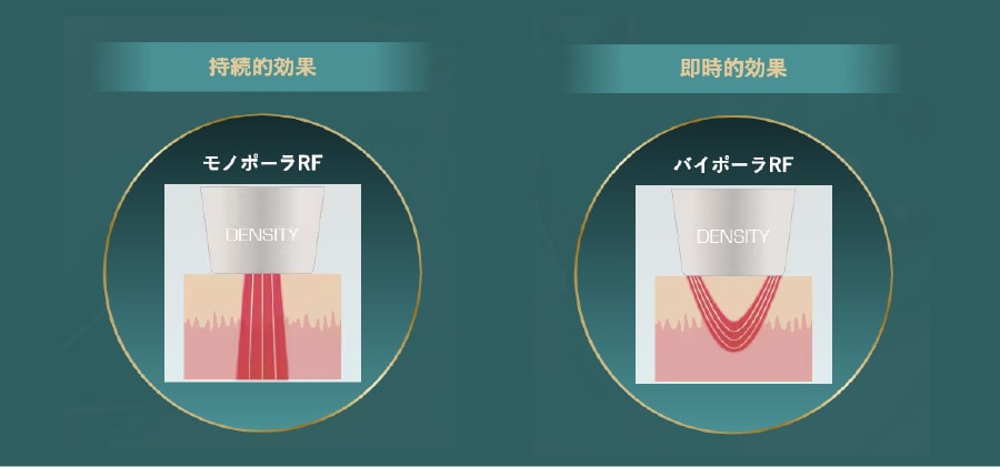 ①特許取得の「モノバイ技術」
