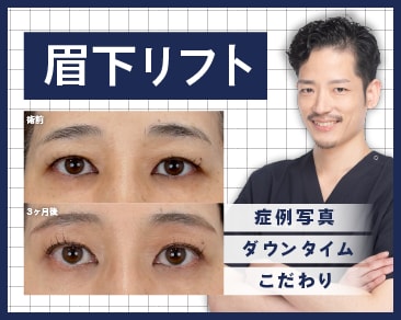 【眉下リフト(切開)】でまぶたのたるみ改善！目元の若返りなら青森県湘南美容クリニック青森院の小原医師に！
