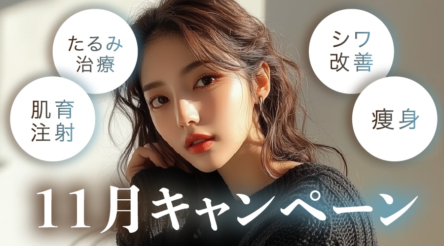 月替わりキャンペーン