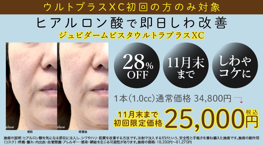 ヒアルロン酸キャンペーン