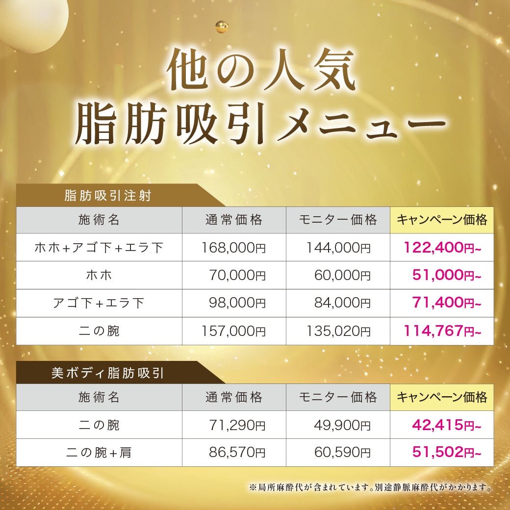 キャンペーン料金表