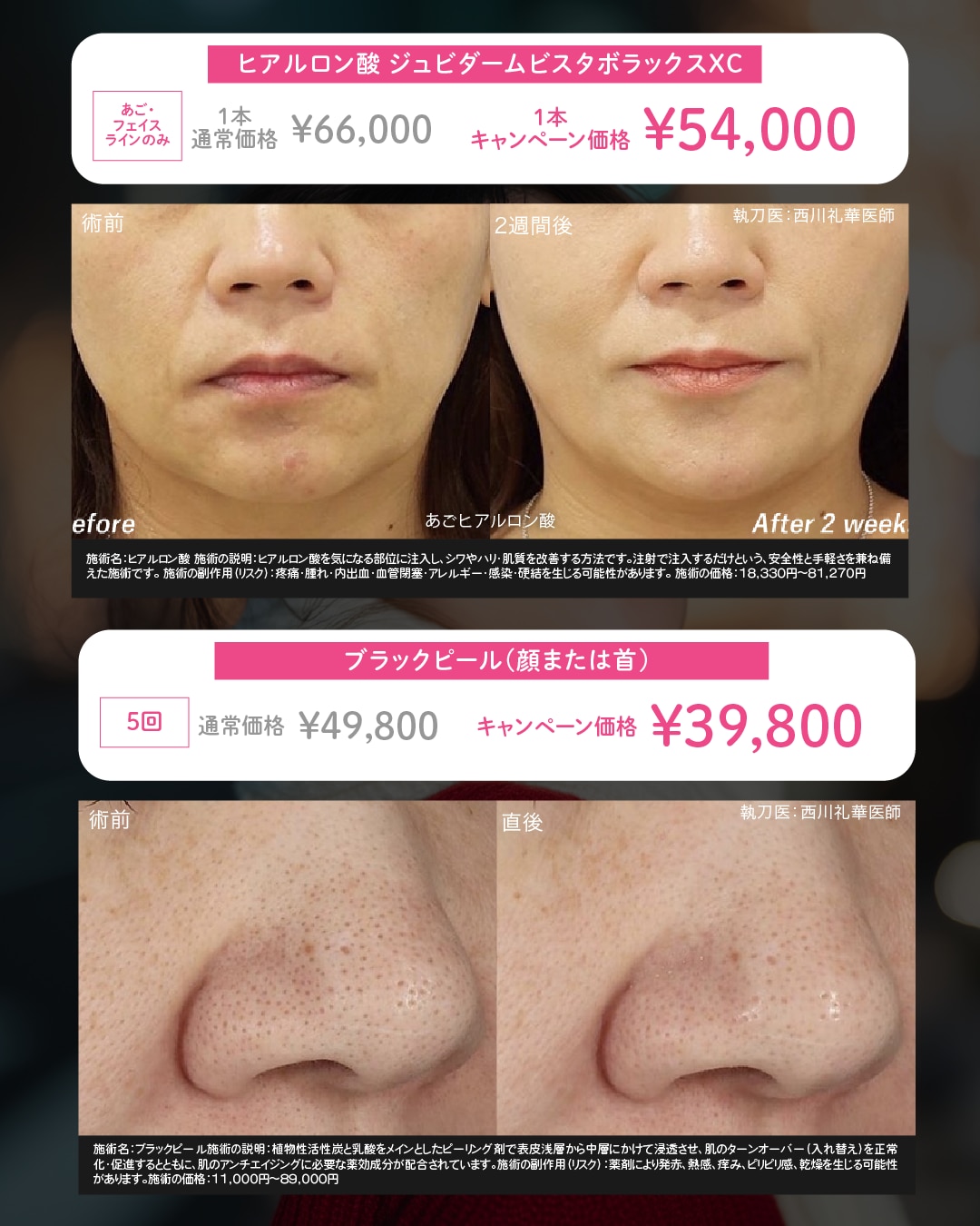 キャンペーン症例写真